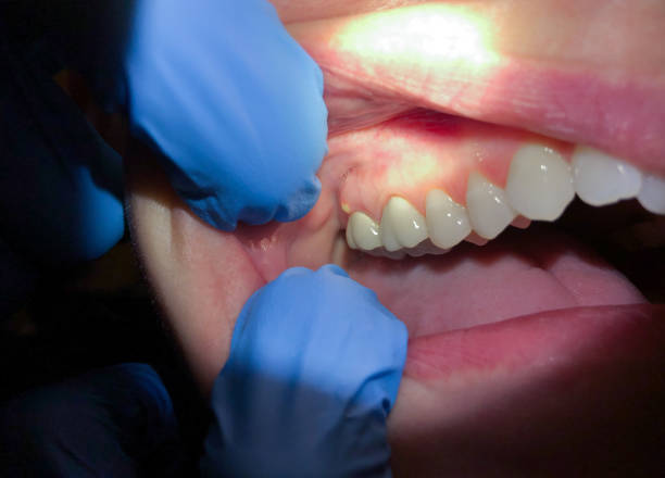 Best Cosmetic Emergency Dentistry in Centrevle, IL