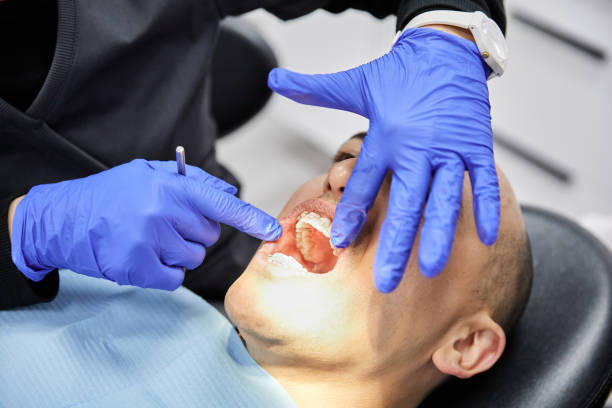 Best Emergency Tooth Extraction in Centrevle, IL