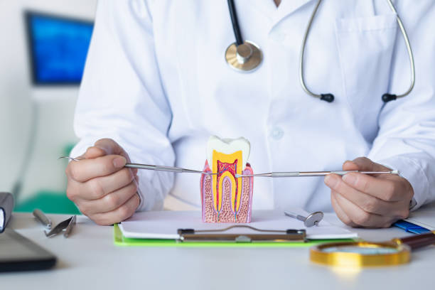 Best Emergency Root Canal Treatment in Centrevle, IL